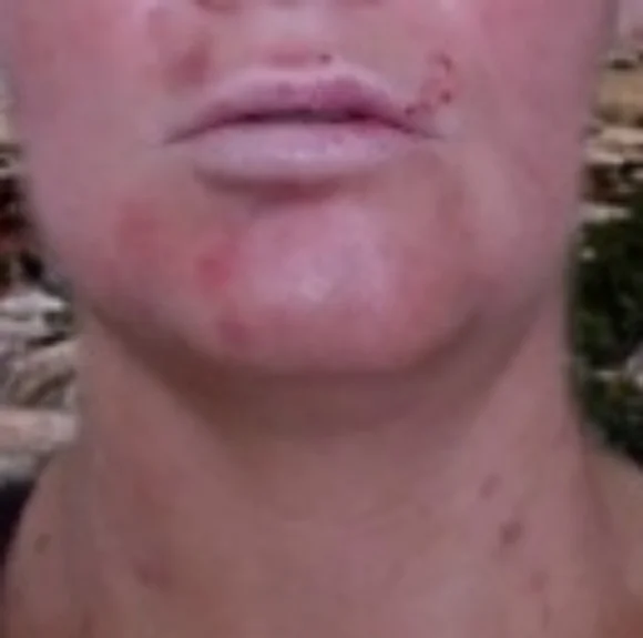 Help - Picture 1 of 4